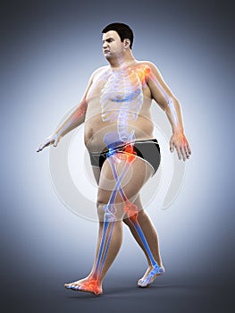 An obese runners painful joints