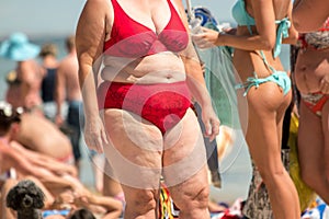 Obese woman in swimsuit.