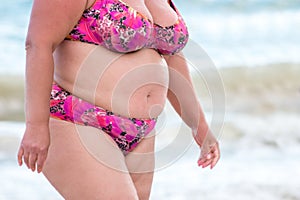 Obese woman in a swimsuit.