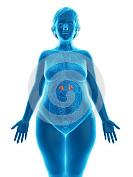 An obese womans adrenal glands