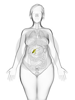 An obese womans gallbladder