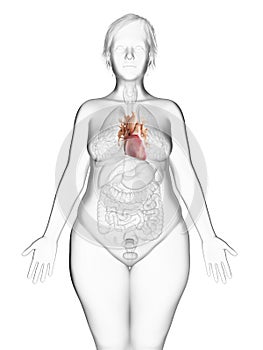 An obese womans heart