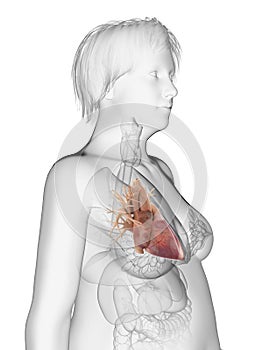 An obese womans heart