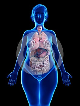 An obese womans internal organs