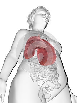 An obese womans lung