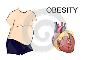 Obesity. body and heart