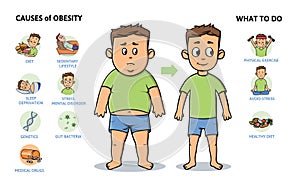 Obesity causes and prevention. Young guy before and after diet and fitness. Colorful infographic poster with text and
