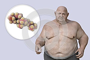 Obesity and dyslipidemia, conceptual 3D illustration showing cholesterol molecule and overweight person