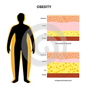 Obesity fat level