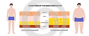 Obesity fat level