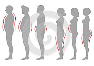 Obesity woman and man body type, vector figure overweight silhouette