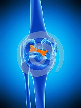 The oblique politeal ligament