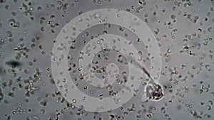 Observation of the ciliate vorticella under the microscope