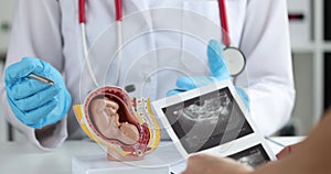 Obstetrician gynecologist showing artificial model of fetus in human uterus to woman with ultrasound scan closeup 4k