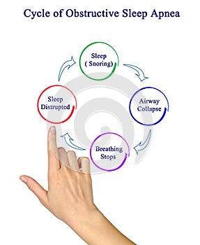 Obstructive Sleep Apnea