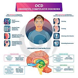 OCD obsessive compulsive disorder labeled explanation vector illustration.