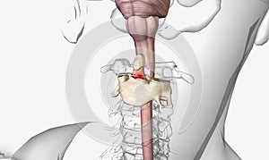 Odontoid (dens) fractures refer to the second cervical vertebra