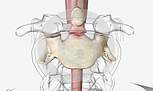 Odontoid (dens) fractures refer to the second cervical vertebra