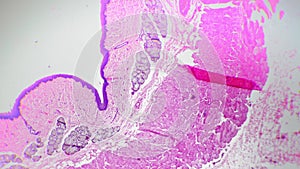 Oesophagus of human being in transversal section magnified 40x under microscope against bright field