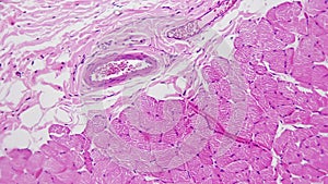 Oesophagus of in transversal section magnified in 200 times under microscope against bright field