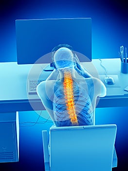 An office worker having backache