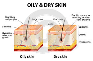 Oily & dry skin