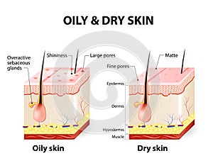 Oily & dry skin photo