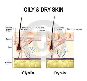 Oily and dry skin photo