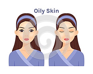 Oily Skin. Isolated Beautiful Brunette woman. Cute face. Skin disease.Treatment.Woman with open eyes and closed. White background
