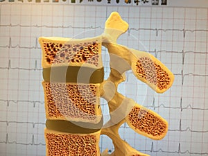 Old anatomical model of human vertebral column