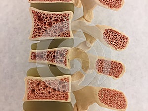 Old anatomical model of human vertebral column