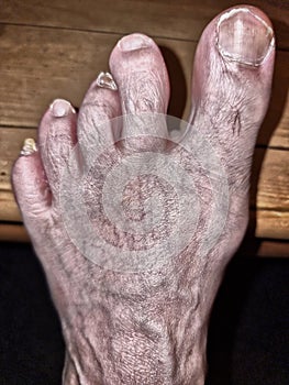 Old Dirty Human Foot Disfigured photo