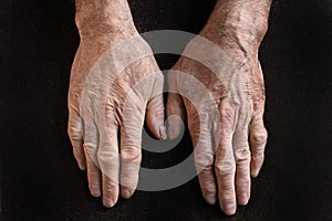 Old hands