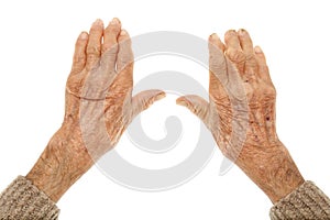 Old hands with artritis