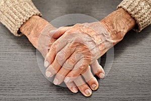 Old hands with artritis photo