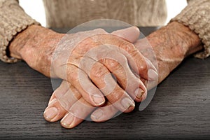 Old hands with artritis photo