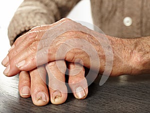 Old hands with artritis photo