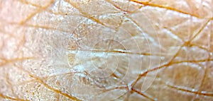 old human skin at microscope