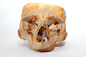 Old human skull