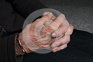 Old lady hands with arthritis