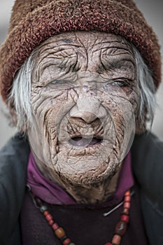 Old lady from Lamayuru village with eye problems cataracts glaucoma