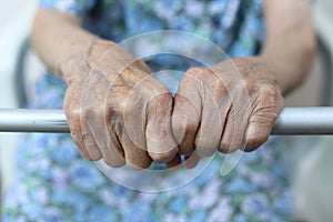 Old lady`s hand. Elderly lady is waiting for help. Senior lady experiencing bad service and conditions in retirement