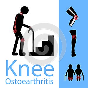 Old man pain at his knee , Osteoarthritis knee flat design Health care concept