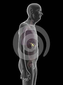 an old mans gallbladder