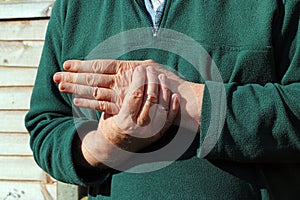 Old mans left hand. Pain, arthritis.