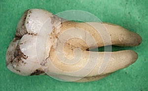 Old molars of humans