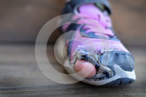 Old shoes with holes homeless toes sticking out