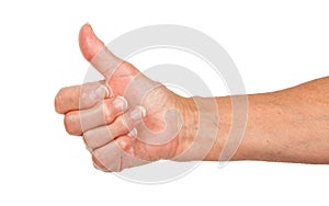 Old woman with arthritis giving the thumbs up sign