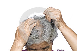 Old woman felt a lot of anxiety about hair loss issue