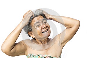 Old woman felt a lot of anxiety about hair loss and itching dandruff issue
